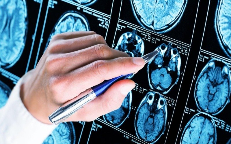 Descubren papel crucial de los condensados de una proteína en el autismo