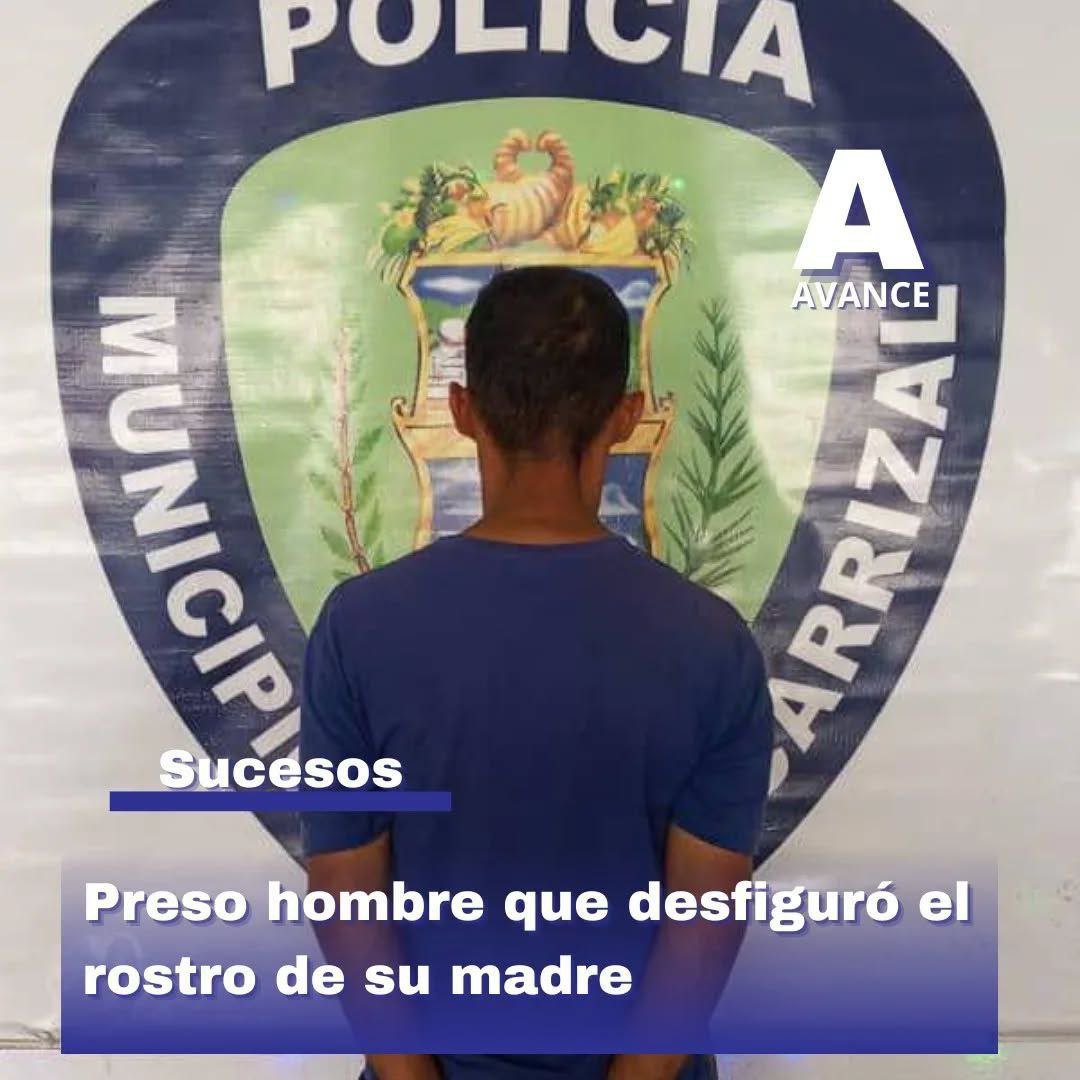 Hombre de  43 años de edad desfiguro el ros tro de su madre