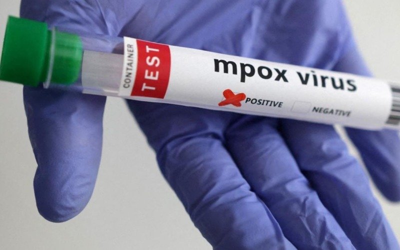 China confirma su primer brote de la nueva variante de la mpox