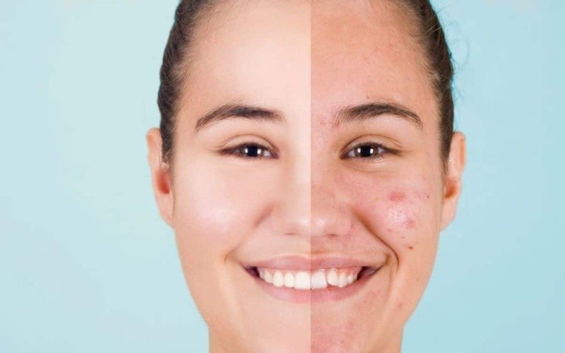 ¿Cómo se refleja el efecto del estrés en el rostro?