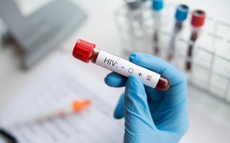 Filipinas vive epidemia del VIH desbocada con un aumento del 411 % en una década