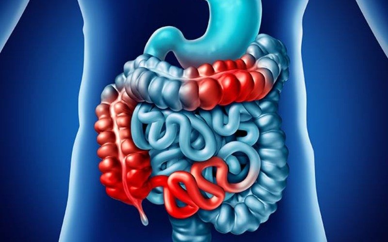 Consejos para mejorar la microbiota intestinal