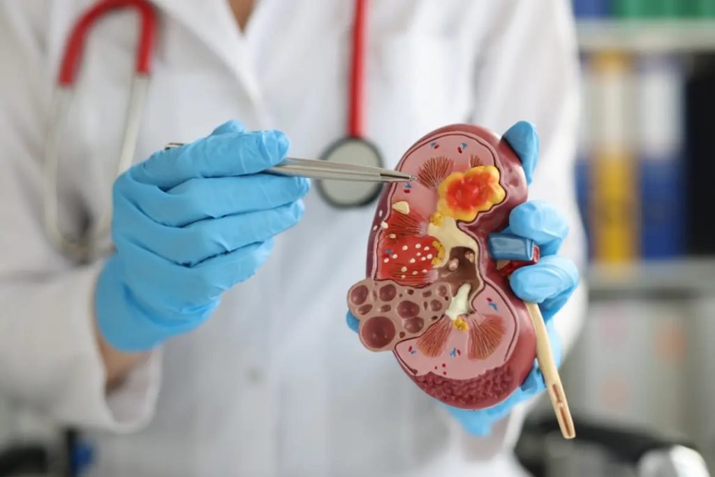 Enfermedad renal crónica afecta en su mayoría a la población adulta