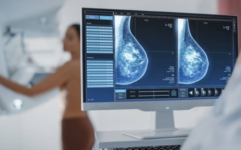 Dietas grasientas favorecen la metástasis del cáncer de mama