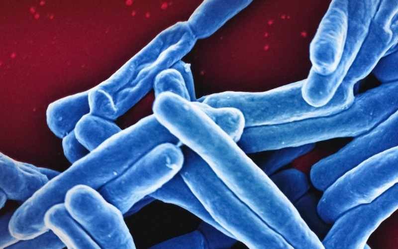 Examen molecular de heces permite la detección de tuberculosis en personas con VIH