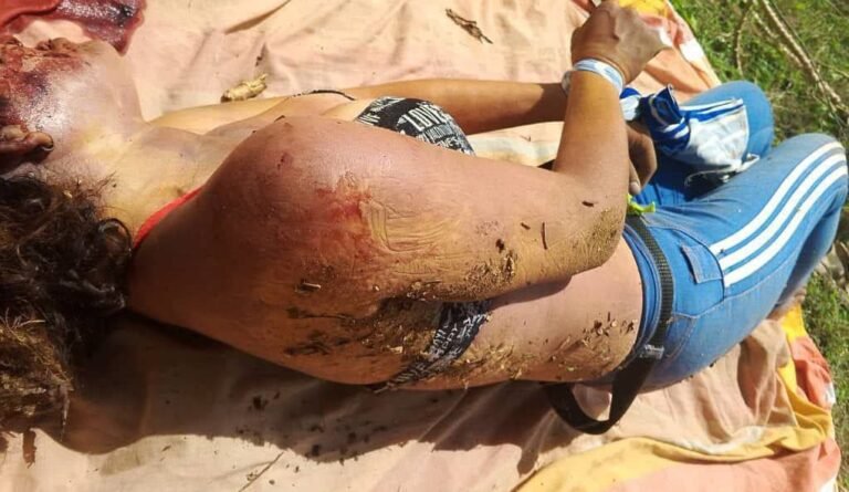 Encuentran sin vida a alias «La Flaca» en Punta de Mata
