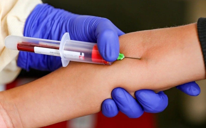 EE.UU. aprueba el primer test sanguíneo para ayudar en la detección del alzhéimer